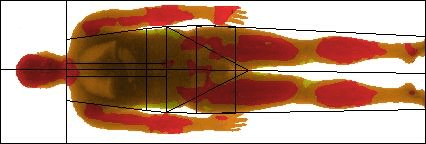 heat map of body